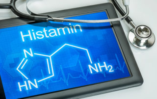 Chemische Strukturformel von Histamin