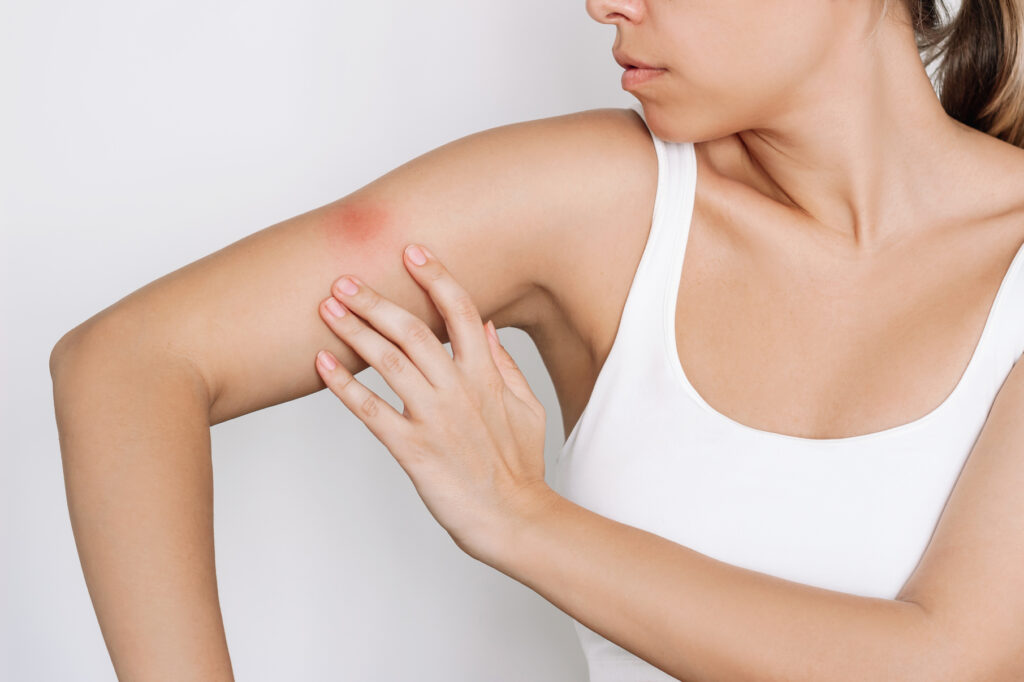 Nebenwirkungen Grippeimpfung bei Histaminintoleranz