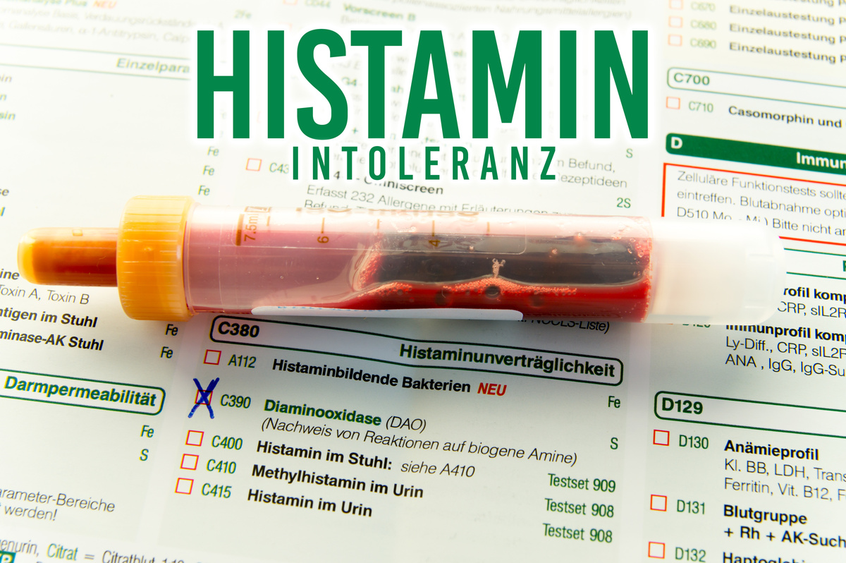 Diaminoxidase bei Histaminintoleranz